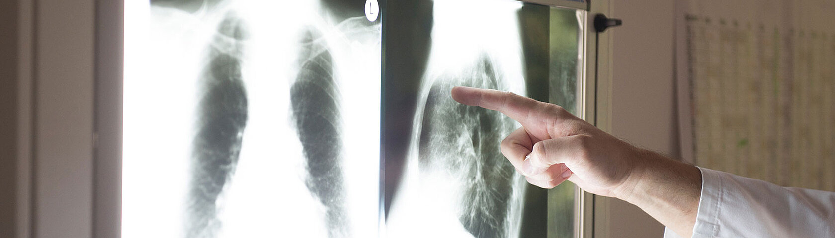Diagnostik Finger zeigt auf Röntgenbild KfN München