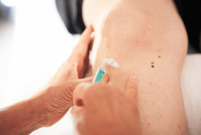 Arzt wendet Neuraltherapie am Knie eines Patienten an